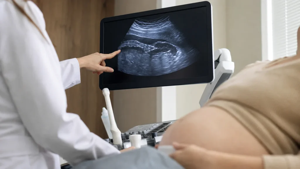 Consulta de medicina fetal avaliando insercao velamentosa do cordao no ultrassom sem identificacao de paciente